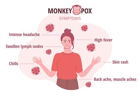 Pregnancy and monkeypox